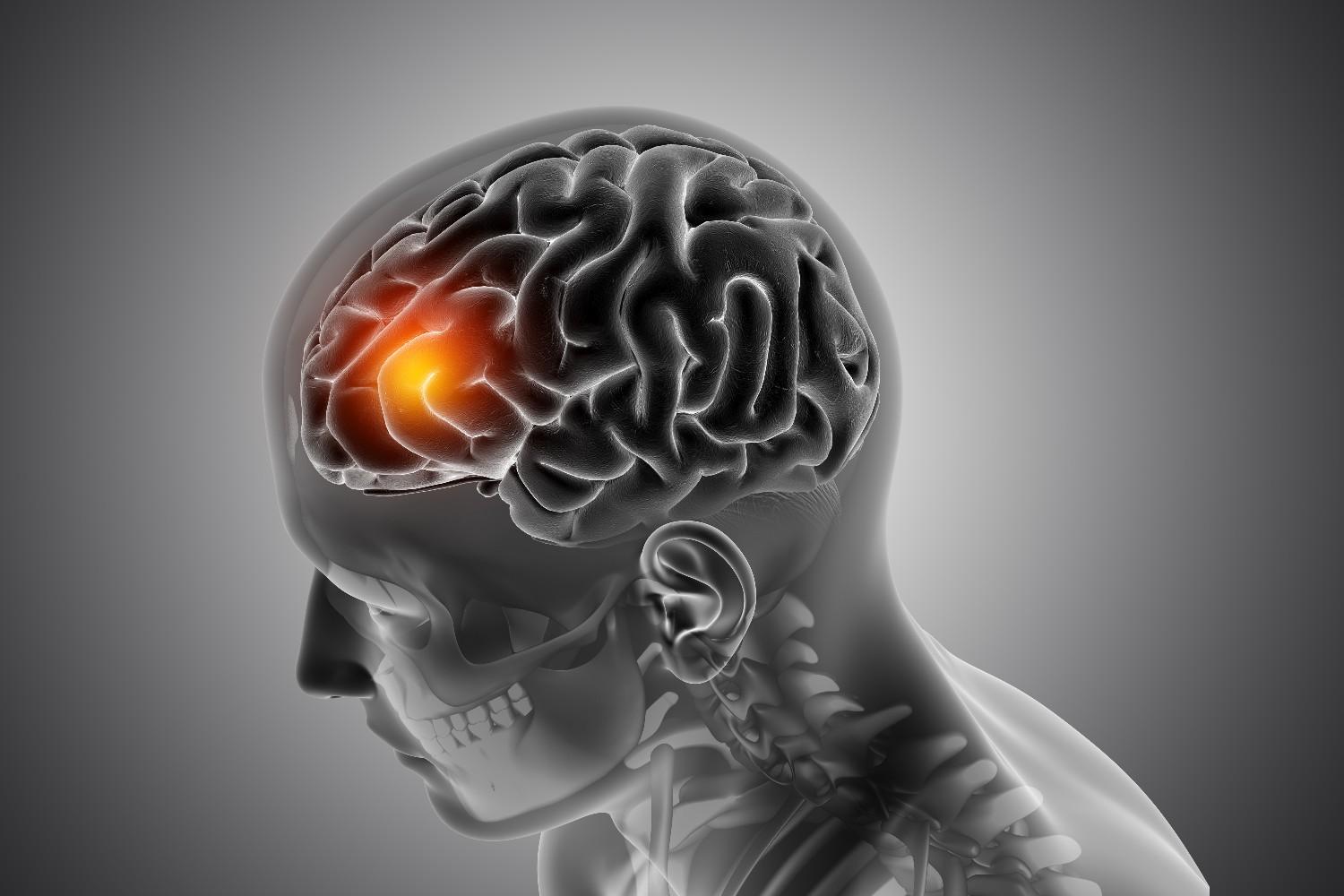 male-medical-figure-with-front-brain-highlighted (1)